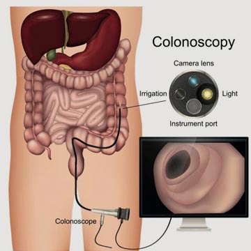 colonoscopy Dr Thania Kahn Home